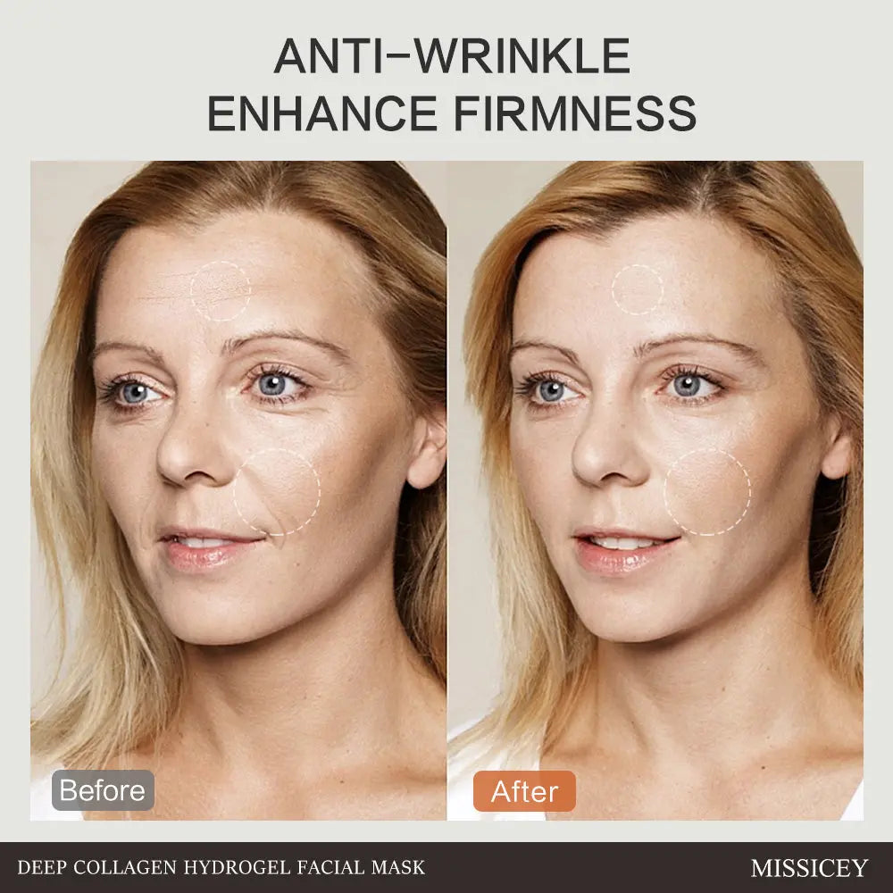 MISSICEY Deep Collagen Hydrogel Facial Mask 16 PCS Moisture Skincare