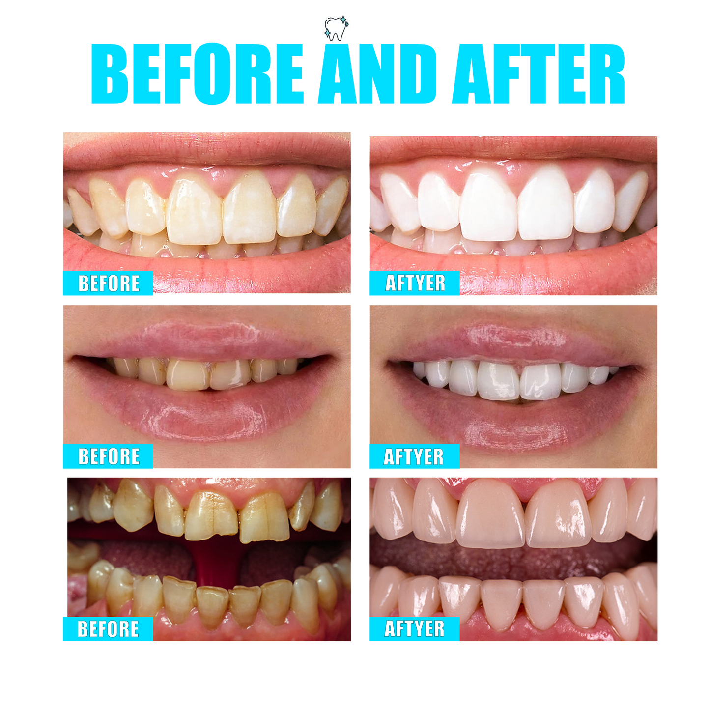 MISSICEY Toothpaste Tablets – Fluoride-Free,   Whitening – Natural, Eco-Friendly Travel Tabs